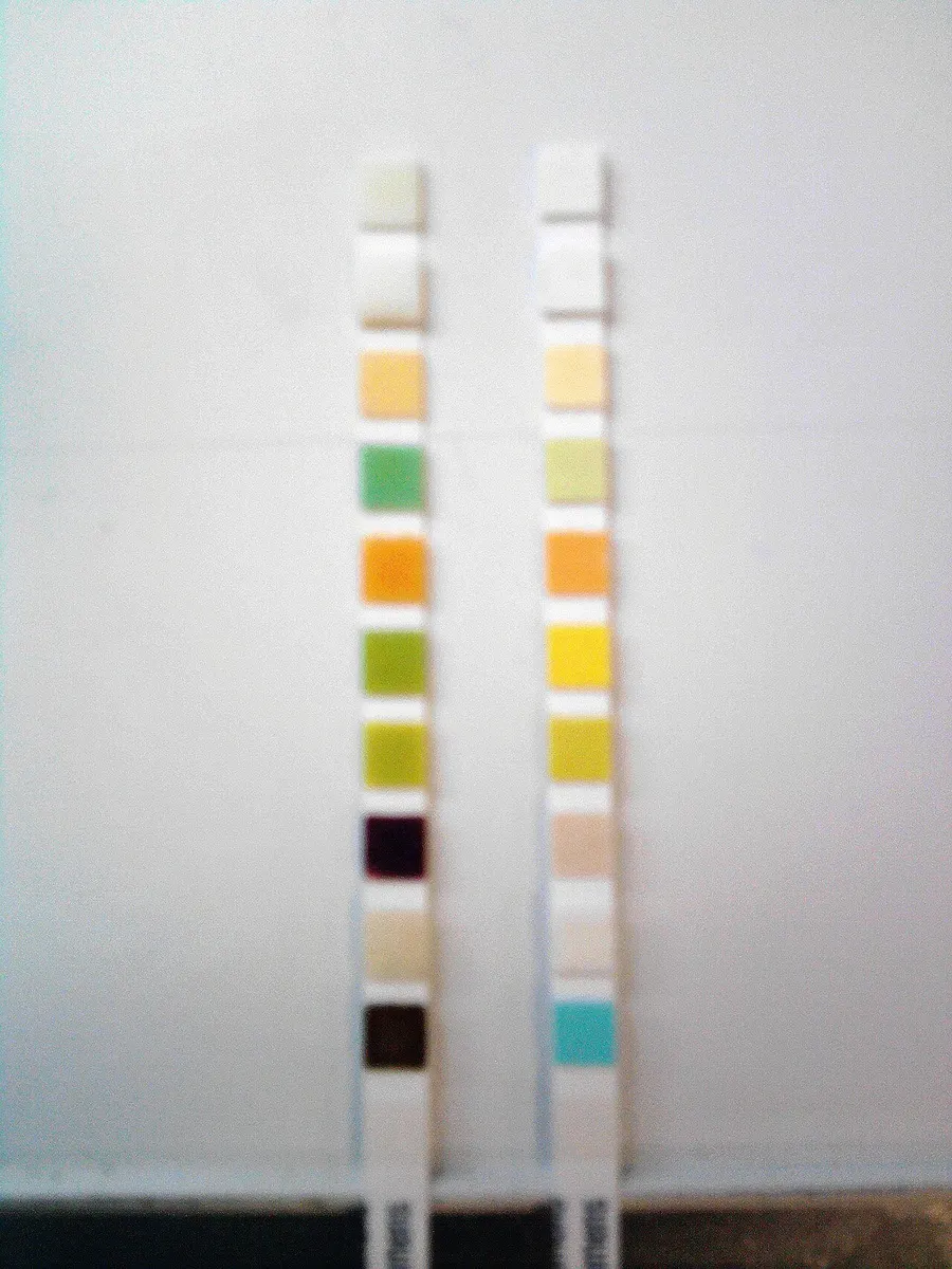 Home & lab tests - urine test strip