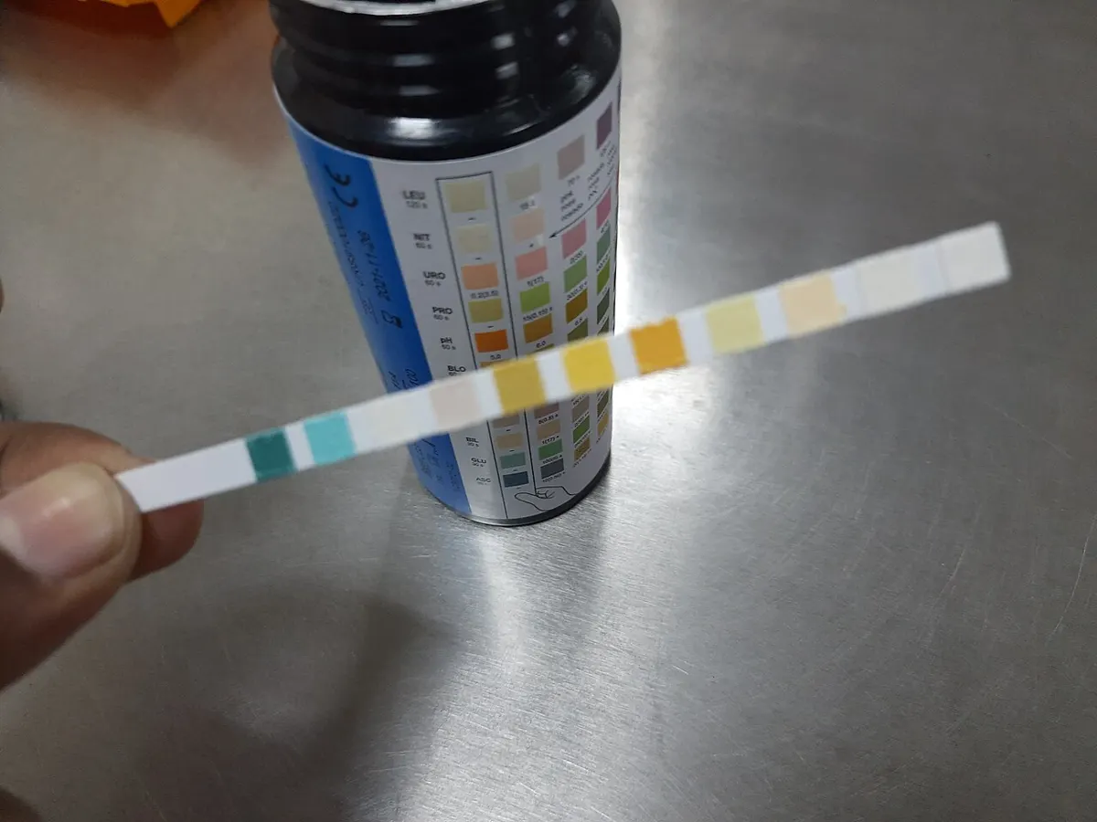 Urine test strip - drug test answers