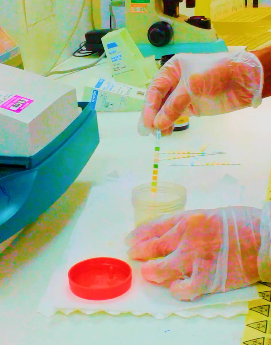 urine test strip