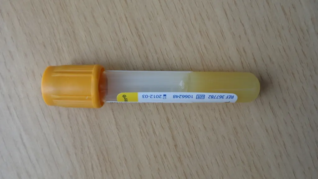 Blood collection tube - how long does cocaine stay in blood vs urine
