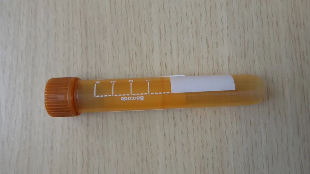 how long does weed stay in your system blood work - blood collection tube