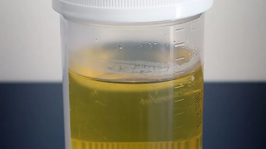 Urine specimen cup - can you fail drug test from secondhand smoke