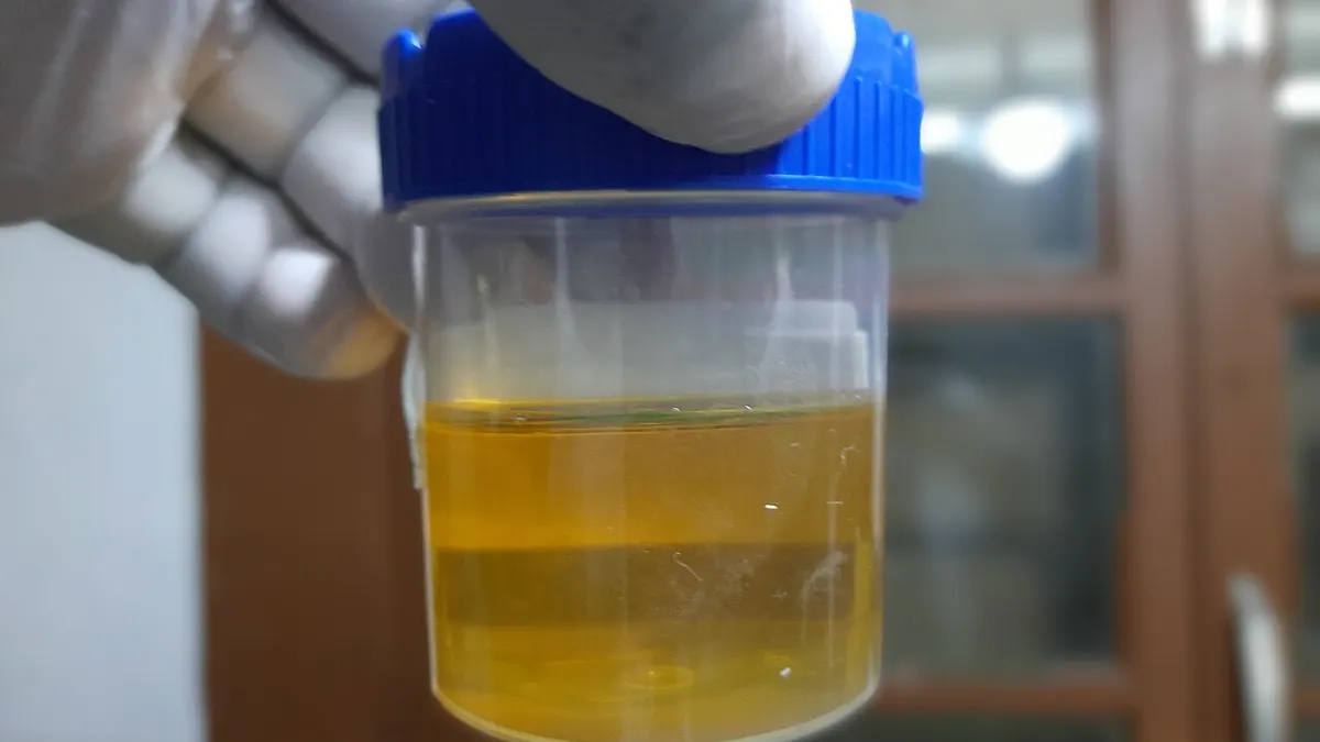 Urine specimen cup - how can i pass a urine drug test