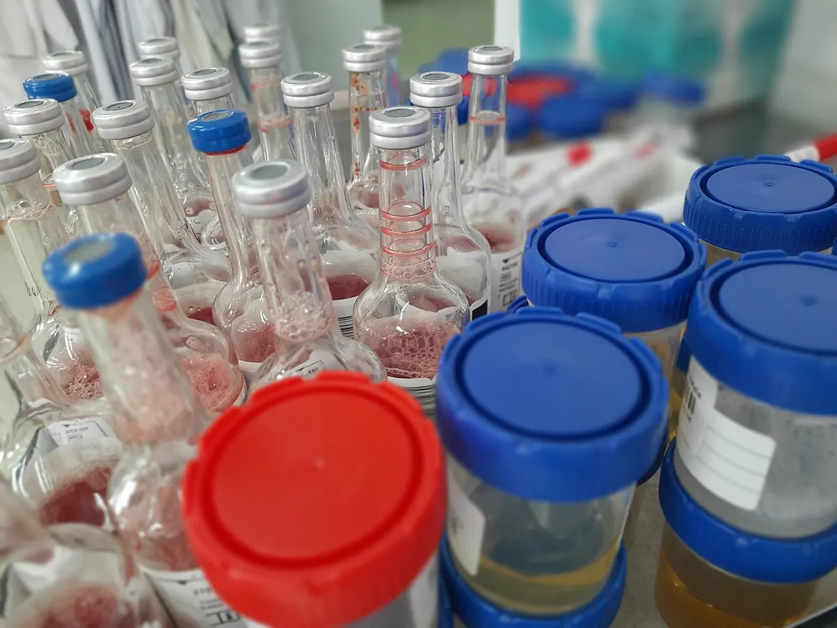Specimen containers - how long does alcohol stay in urine vs blood