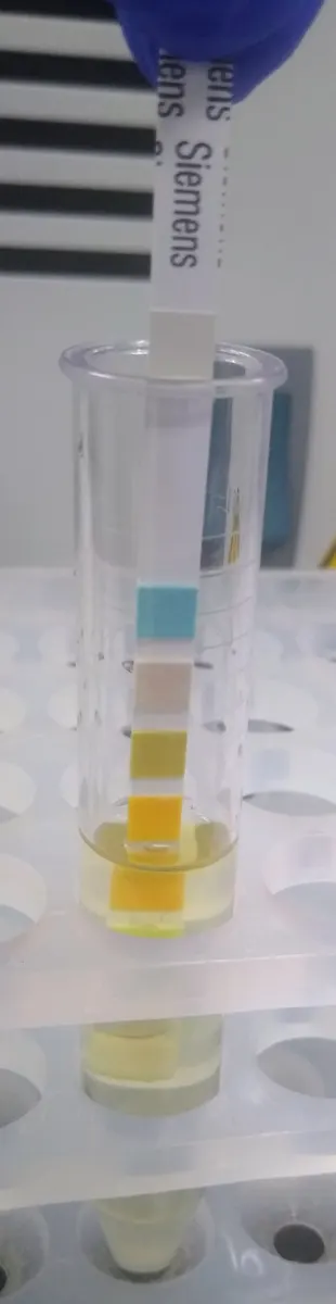 specimen containers